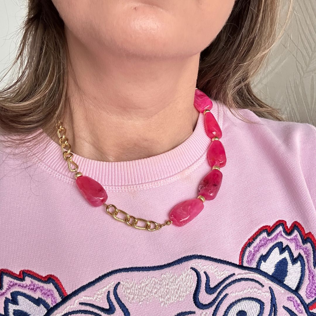 Deze grove schakelketting met gemarmerde fuchsia acryl kralen is een echte eyecatcher. De chunky schakels geven de ketting een stoer en trendy karakter, terwijl de fuchsia marmerlook zorgt voor een speelse en luxe uitstraling.

Perfect om een blouse direct meer power te geven, maar ook verrassend mooi op een warme trui. Deze ketting is gemaakt voor vrouwen die durven op te vallen en hun outfit moeiteloos naar een hoger niveau tillen. Trendy, opvallend en veelzijdig – precies wat een statement accessoire moe